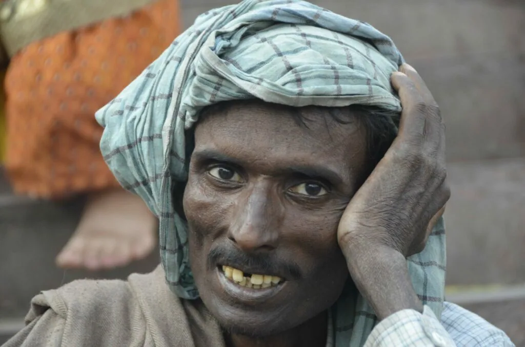 Man wearing light blue checkered head wrap, smiling at camera with hand to face